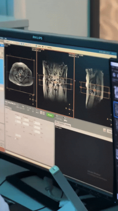 МРТ 3 Тесла в Армавире — точная диагностика нового уровня