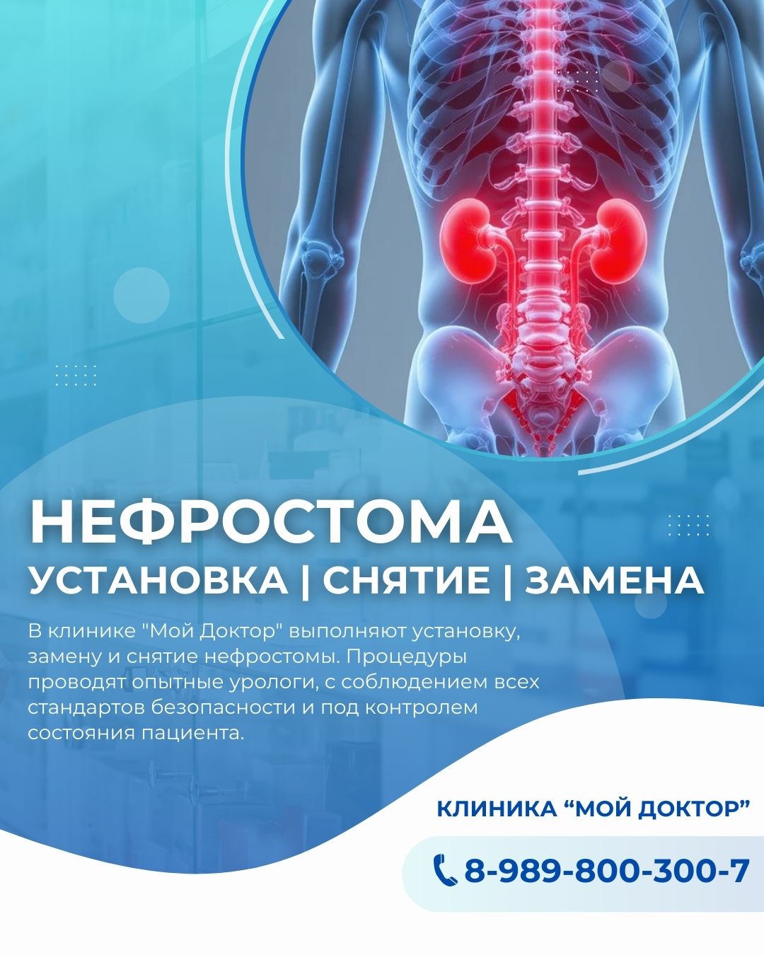 УСТАНОВКА НЕФРОСТОМЫ В АРМАВИРЕ