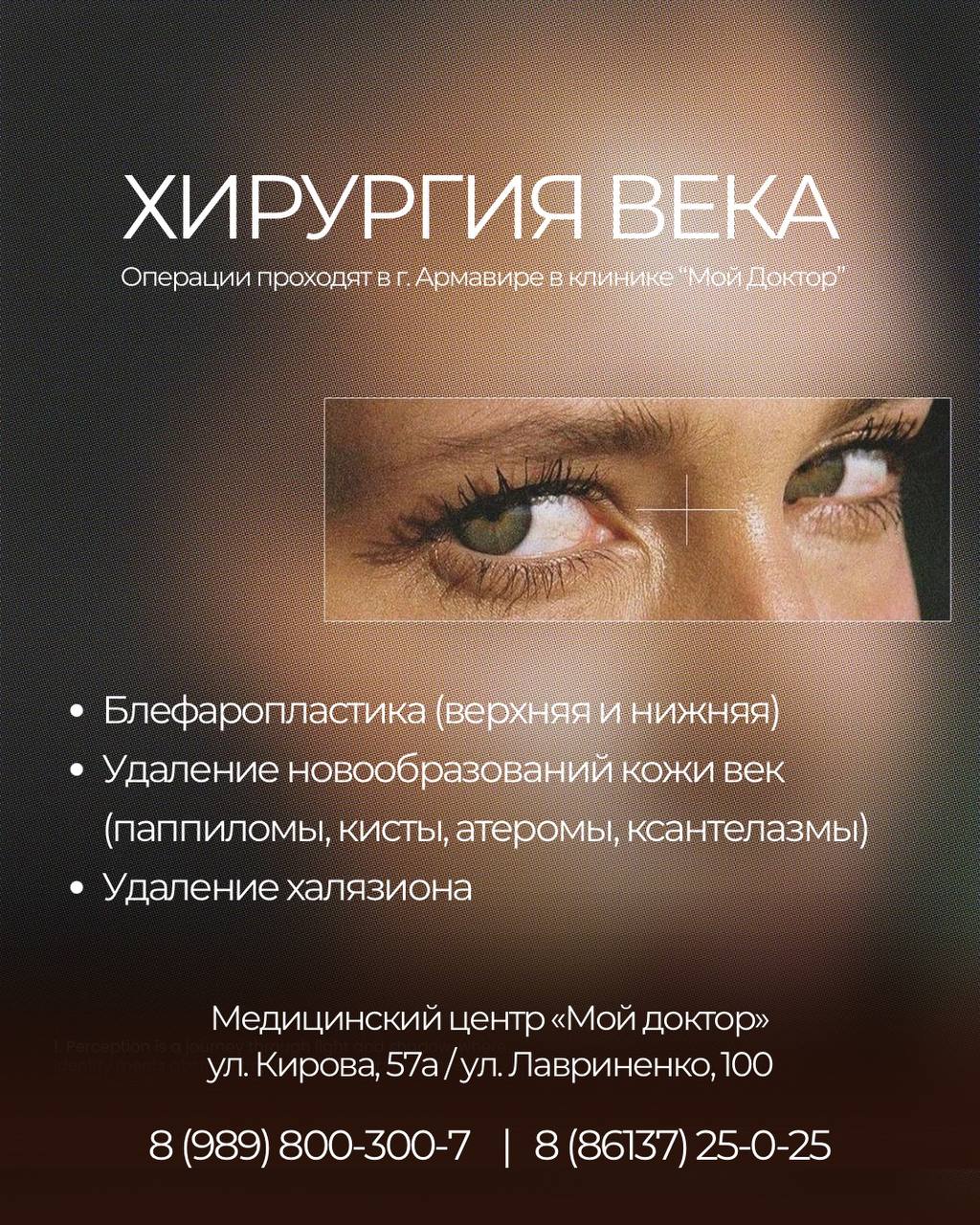 БЛЕФАРОПЛАСТИКА В АРМАВИРЕ | ХИРУРГИЯ ВЕКА