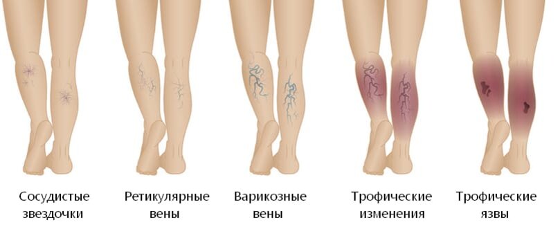 scale_1200 (3).jpg